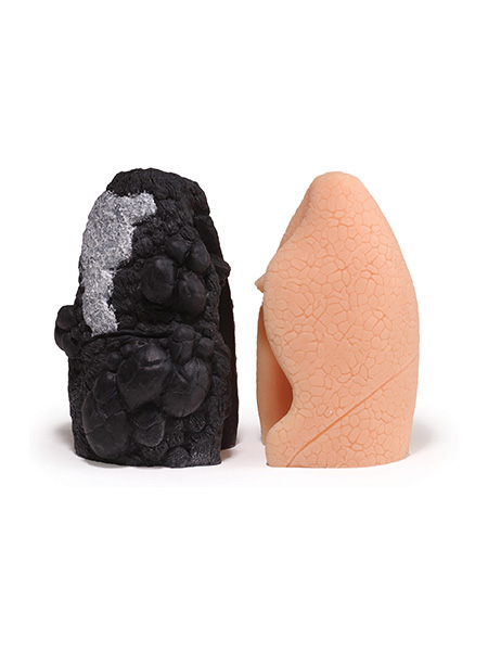 Life Or Death Lungs™ Model Set